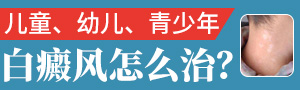 台州治疗白癜风医院