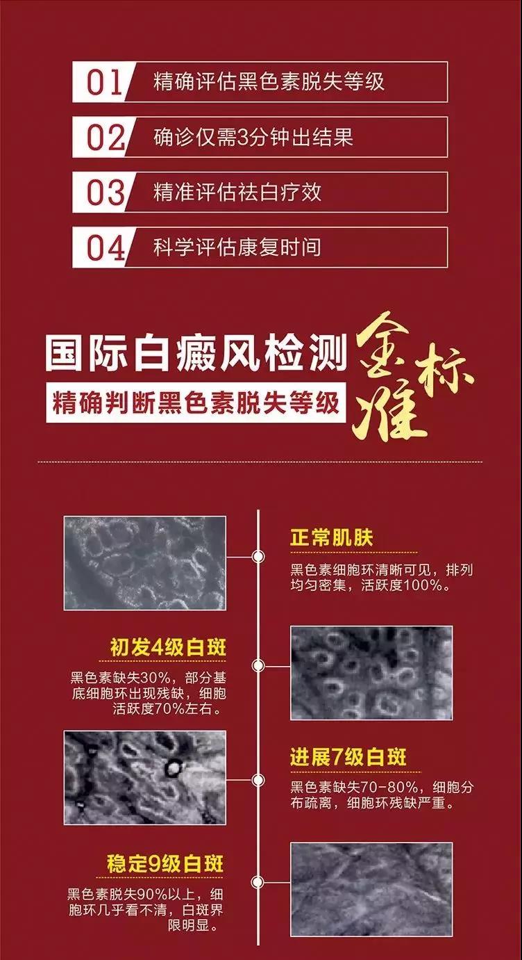 这样确诊白癜风不花钱！浙江省冬季白斑「0元」普查，多重诊断，根表同查